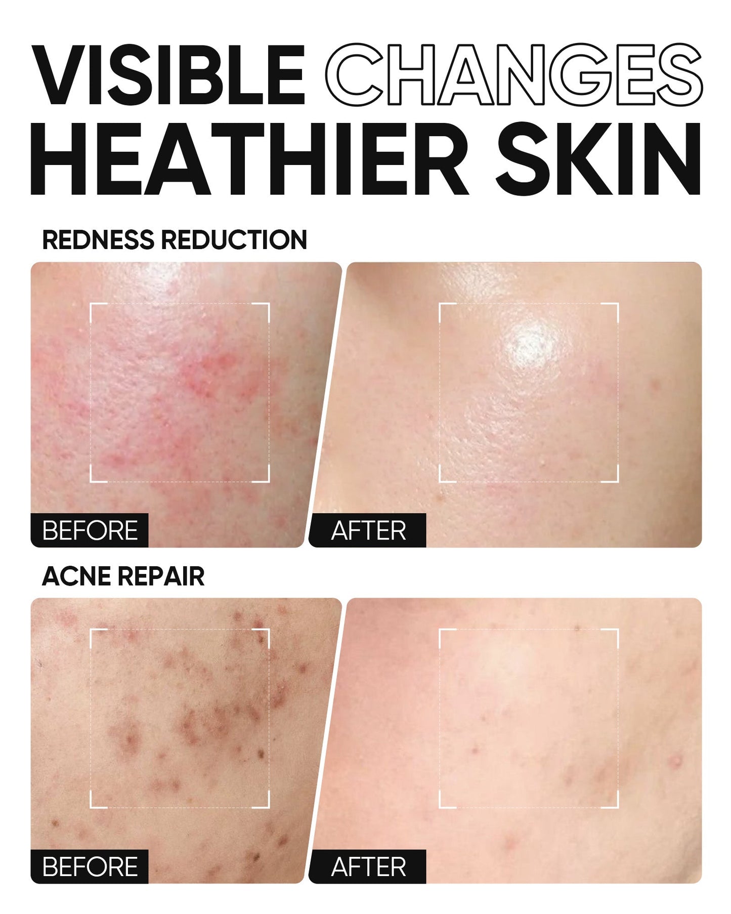 SKINTIFIC 5X Ceramide Barrier Repair Moisture Gel