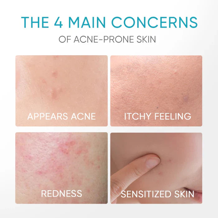 Panthenol Acne Gel Moisturizer