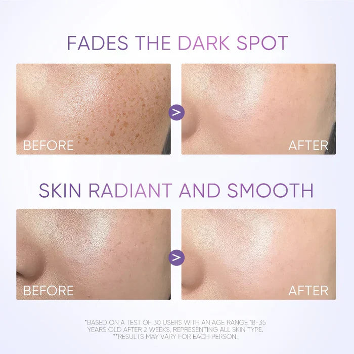 SymWhite Dark Spot Serum