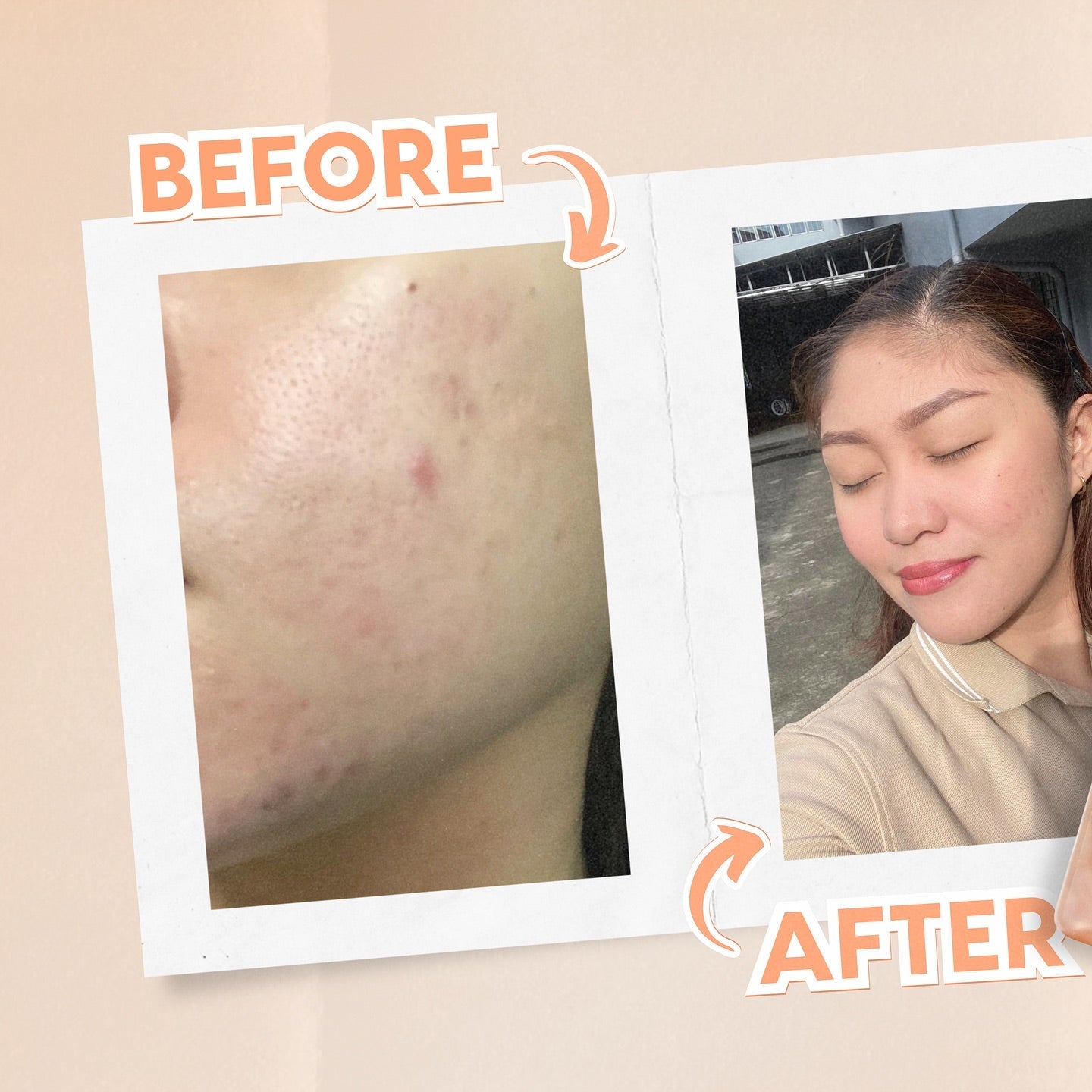 New Moon Soft Glow Glutathione