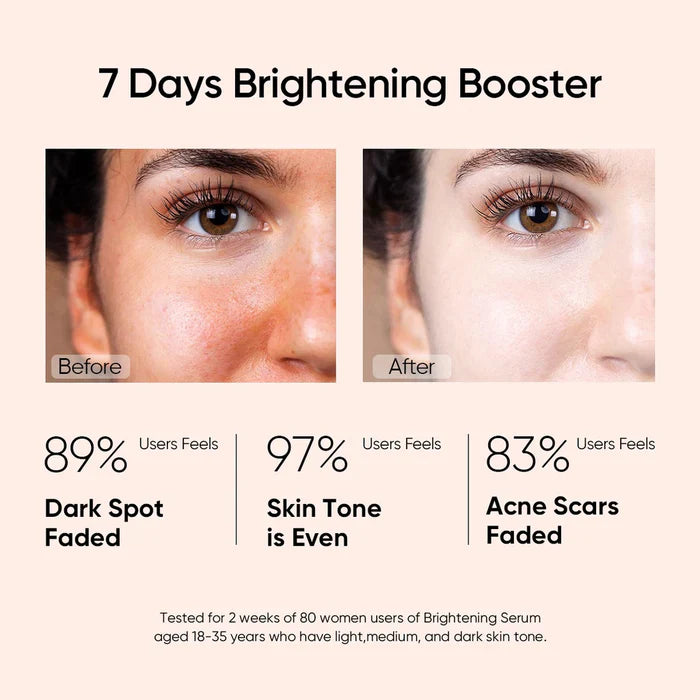 10% Niacinamide Brightening Face Serum