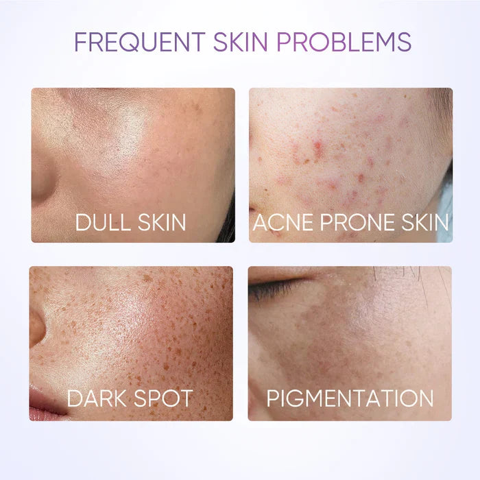 SymWhite Dark Spot Serum