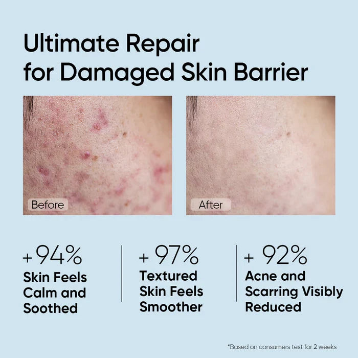 Ceramide Skin Repair Serum