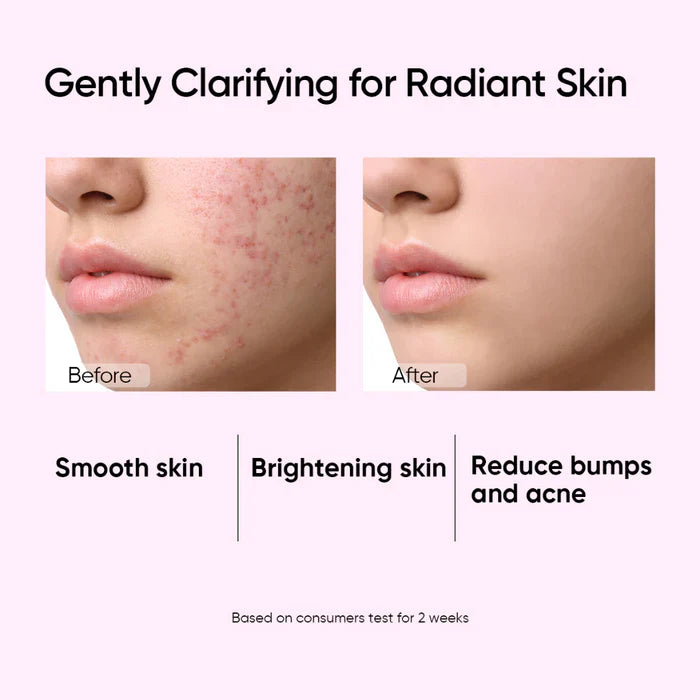 Glycolic Acid Exfoliating Toner 80ml