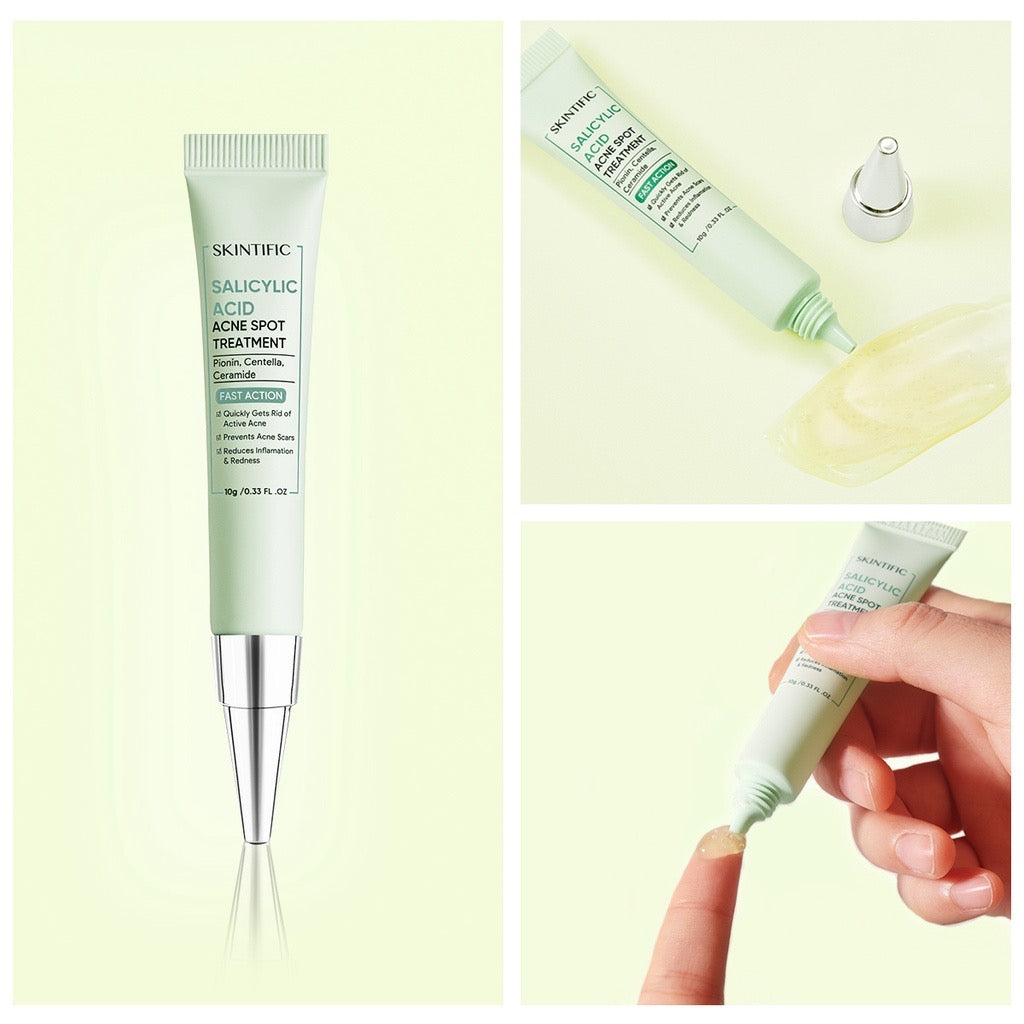 Salicylic Acid Acne 10g Treatment