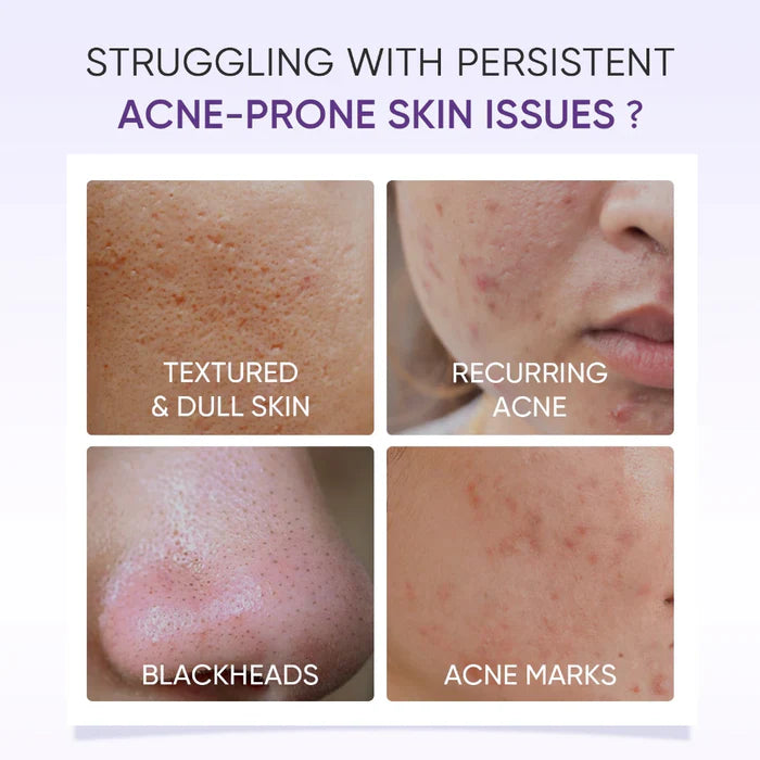 Lactic Acid Exfoliating Serum