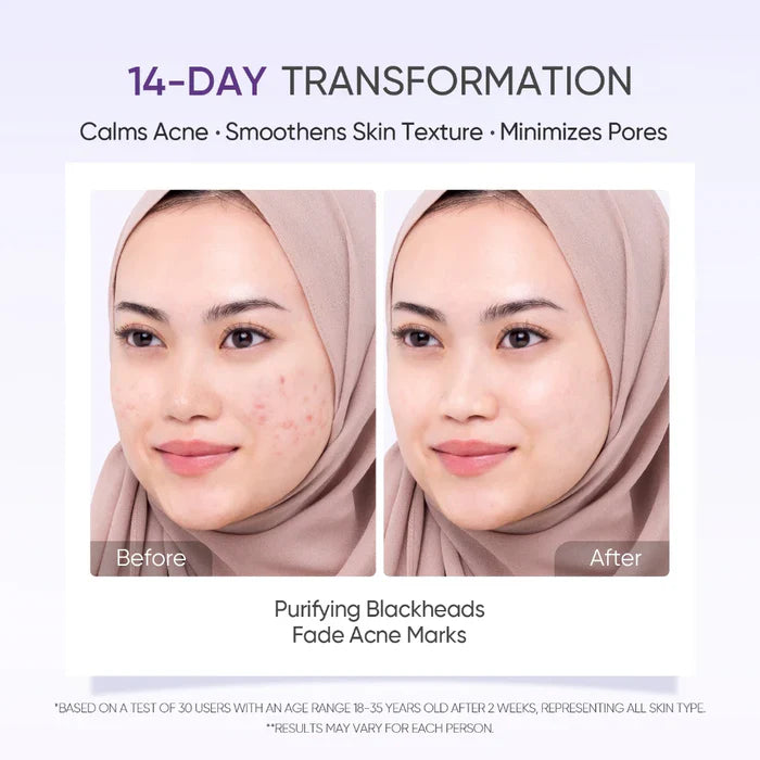 Lactic Acid Exfoliating Serum