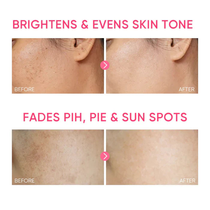 Niacinamide Brightening Gel 30g