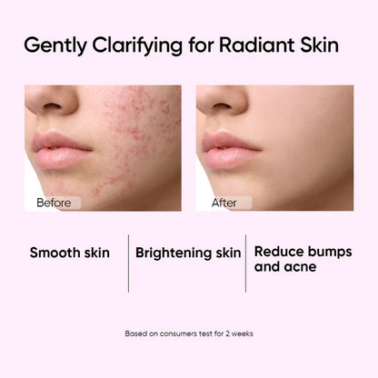 Glycolic Acid Exfoliating Toner 80ml