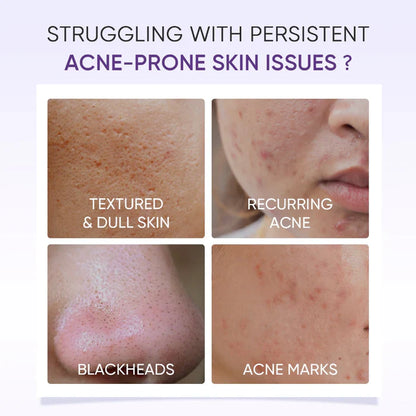 Lactic Acid Exfoliating Serum