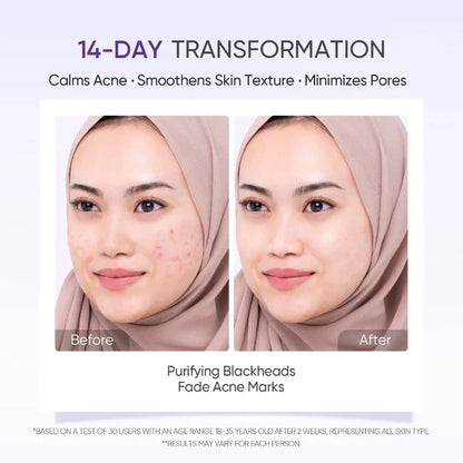 Lactic Acid Exfoliating Serum