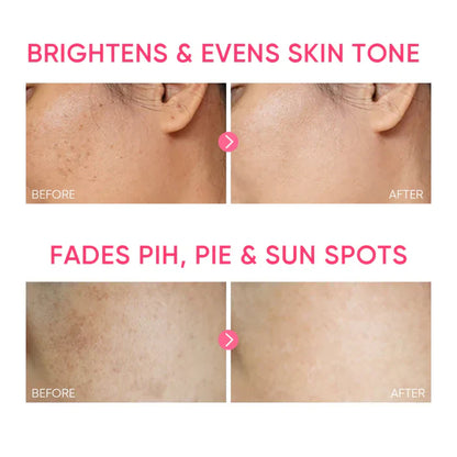 Niacinamide Brightening Gel 30g
